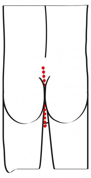 Эрекционное кольцо с цепочкой для стимуляции ягодиц